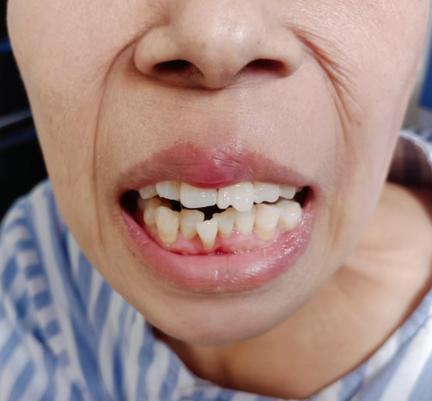 手术麻醉中心攻克困难气道 佑护生命安全