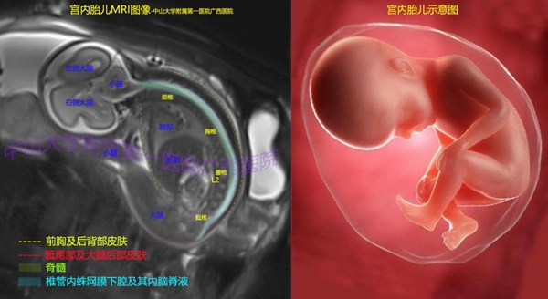皇冠足球投注网
首例胎儿磁共振技术检查成功完成