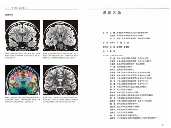 皇冠足球网
放射影像科牵头完成首部主译著作——《癫痫影像病理图解》