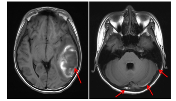 携手破难题 | 皇冠足球网
放射影像科与儿科精准诊断疑难病例